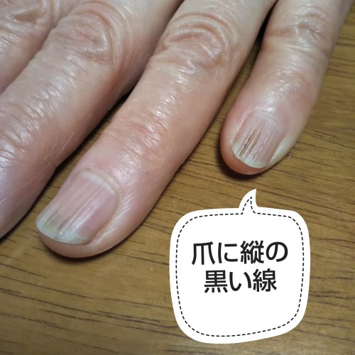 nail cream